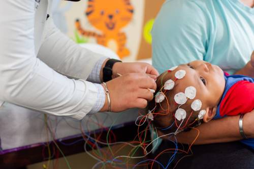 Potenciales Evocados Visuales (PEV)