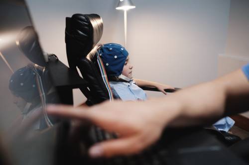 Potenciales Evovados Somatosensoriales (PESS ExSs) y (PESS ExIs)