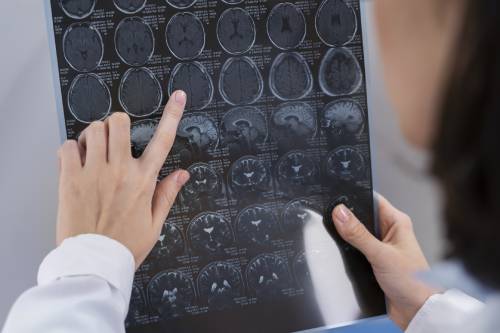 Electroencefalograma Digital (EEG)