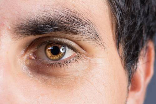 Potenciales Evocados Visuales (PEV)