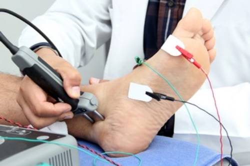 Potenciales Evovados Somatosensoriales (PESS ExSs) y (PESS ExIs)