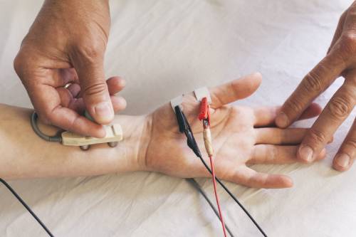 Velocidades Deconducción o Neuroconducción Nerviosa (VCN) y Electromiografía (EMG)