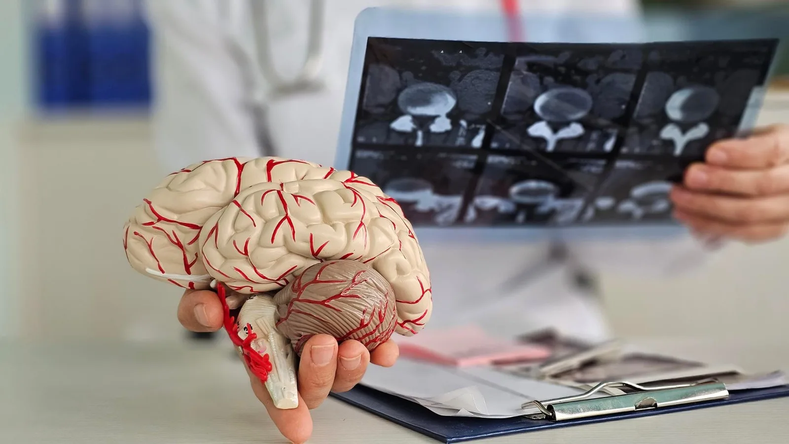Epilepsia: Diagnóstico y atención especializada en la CDMX