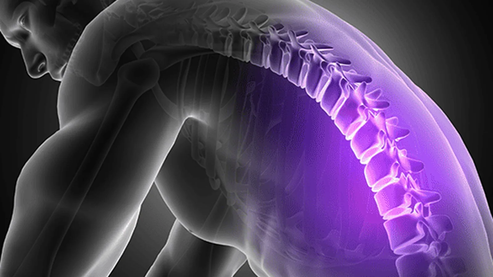 Evaluación Integral de la Neuropatía Periférica en la CDMX